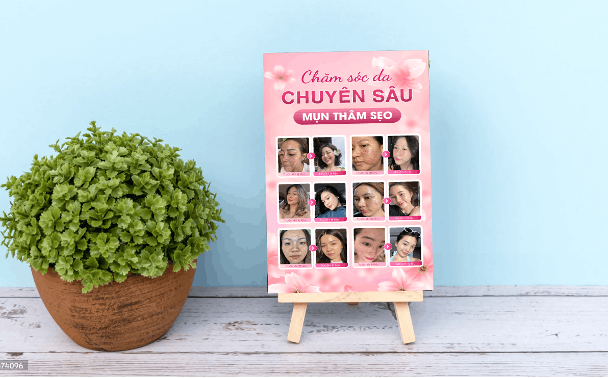https://khotranh.com/lam-dep-spa-beauty-56/bang-cham-soc-da-chuyen-sau-mun-tham-seo.html