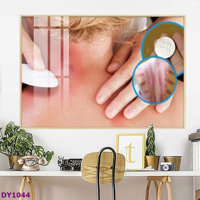 File gốc Tranh trang trí đông y dưỡng sinh spa môi mi DY1044 (bản quyền) cho in ấn