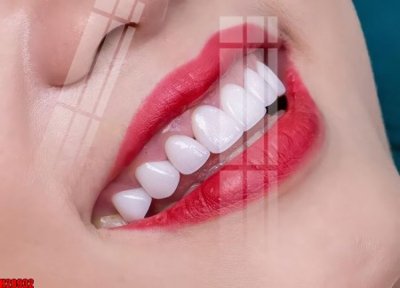 Mua file ảnh gốc File tranh gốc in tranh tường nền tổng hợp H28932 (chất lượng cao)