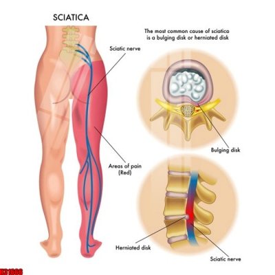 Tải file tranh gốc File tranh gốc in tranh tường nền tổng hợp H31666 chất lượng cao