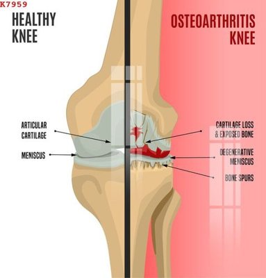 Hình ảnh file gốc File gốc in tranh tổng hợp K7959 cho in UV